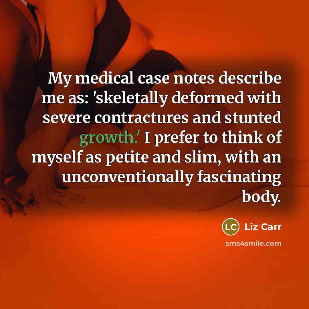 “My medical case notes describe me as: 'skeletally deformed with…” quote by Liz Carr