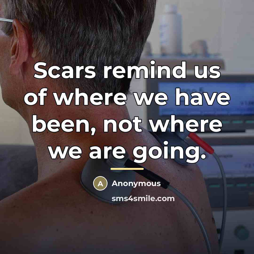“Scars remind us of where we have been, not where…” quote by Anonymous