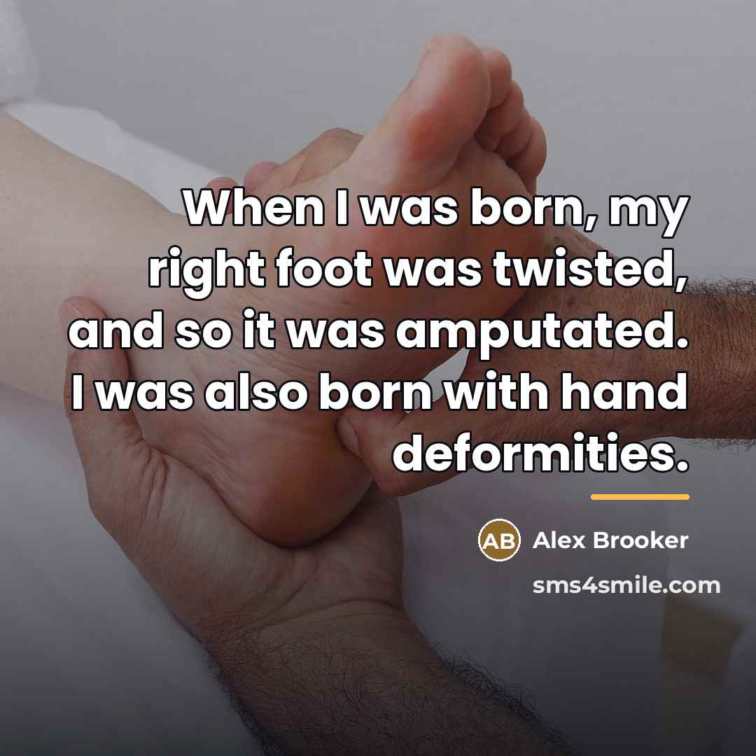“When I was born, my right foot was twisted, and…” quote by Alex Brooker