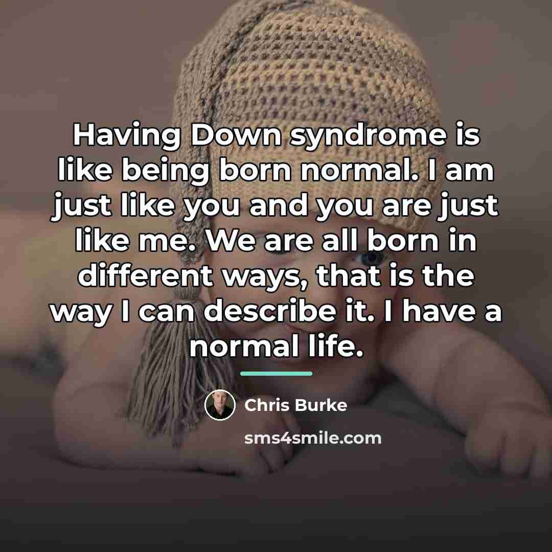 “Having Down syndrome is like being born normal. I am…” quote by Chris Burke