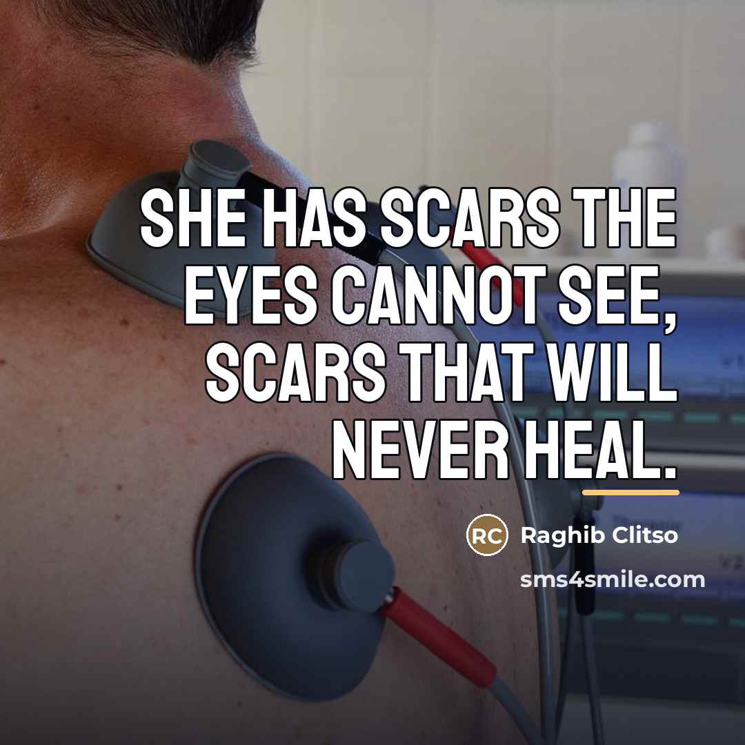 “She has scars the eyes cannot see, scars that will…” quote by Raghib Clitso