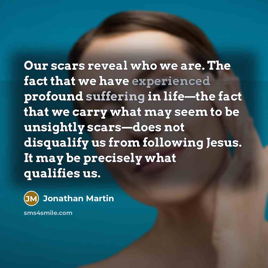“Our scars reveal who we are. The fact that we…” quote by Jonathan Martin