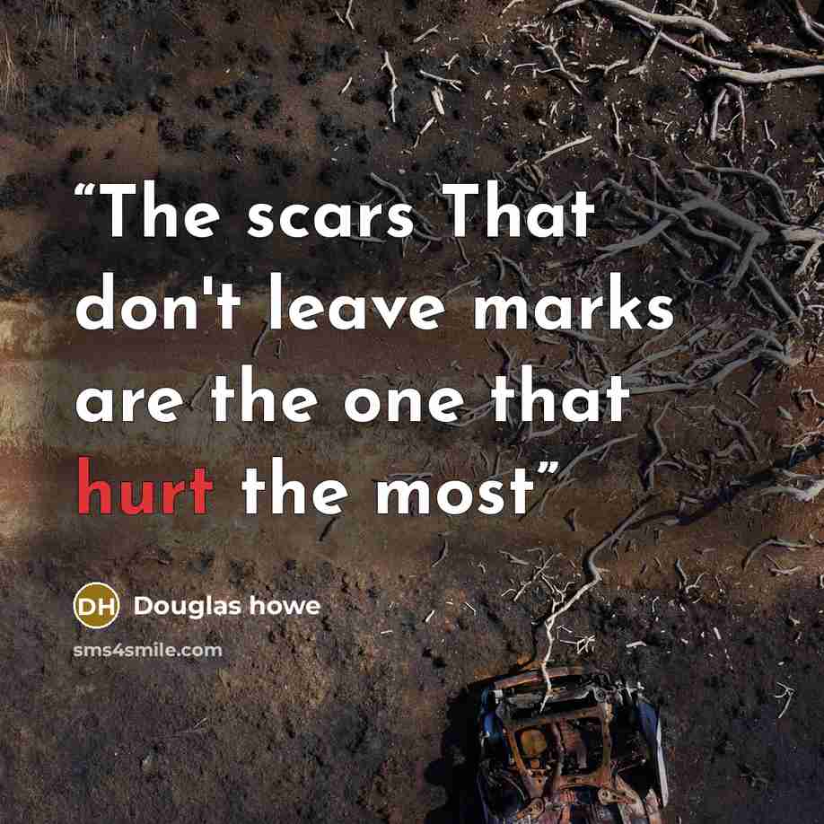 “The scars That don't leave marks are the one that hurt the most” quote by Douglas howe