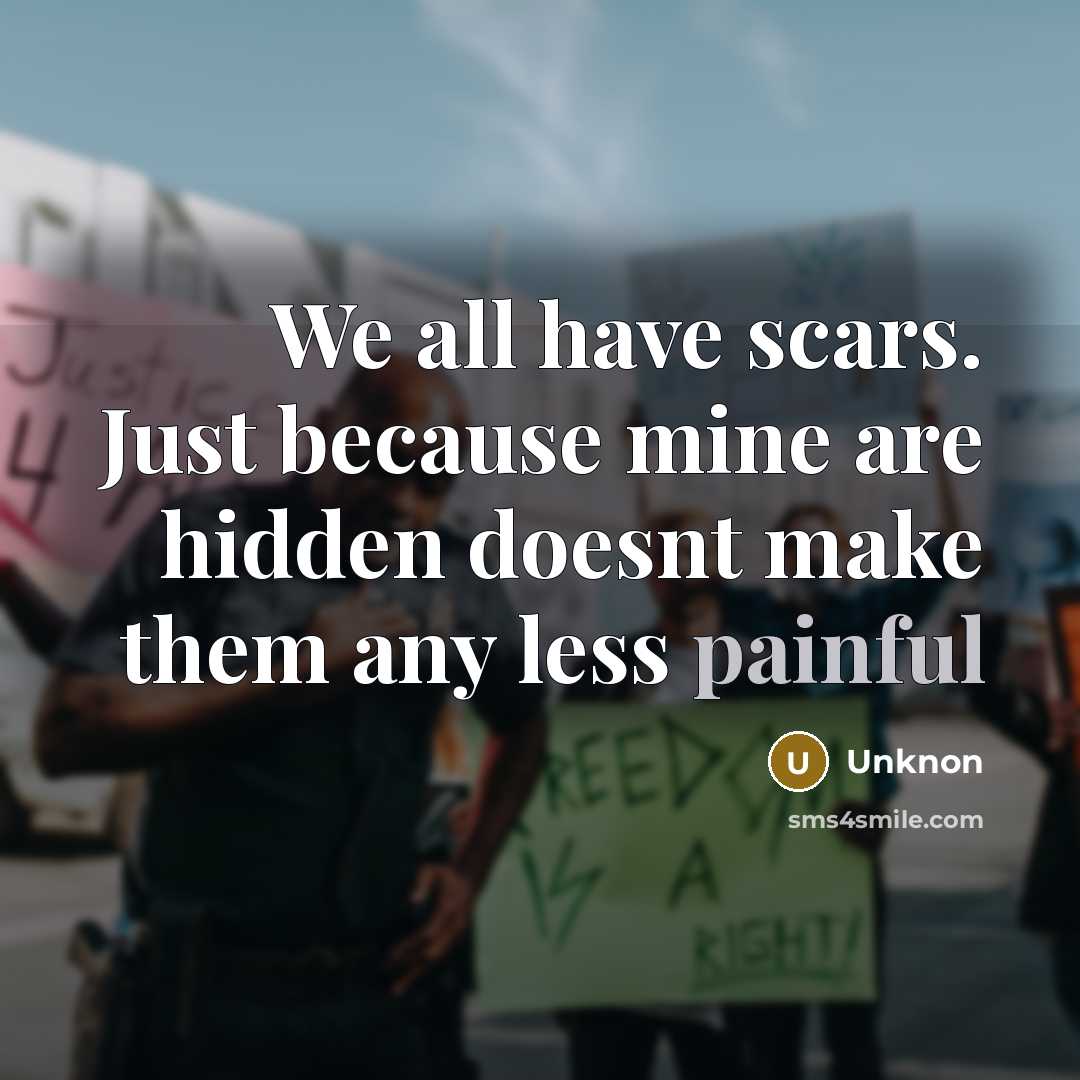 “We all have scars. Just because mine are hidden doesnt…” quote by Unknon