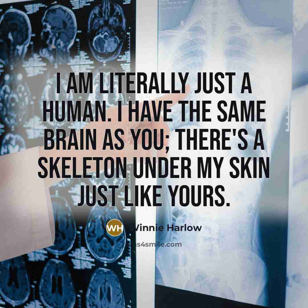 “I am literally just a human. I have the same…” quote by Winnie Harlow