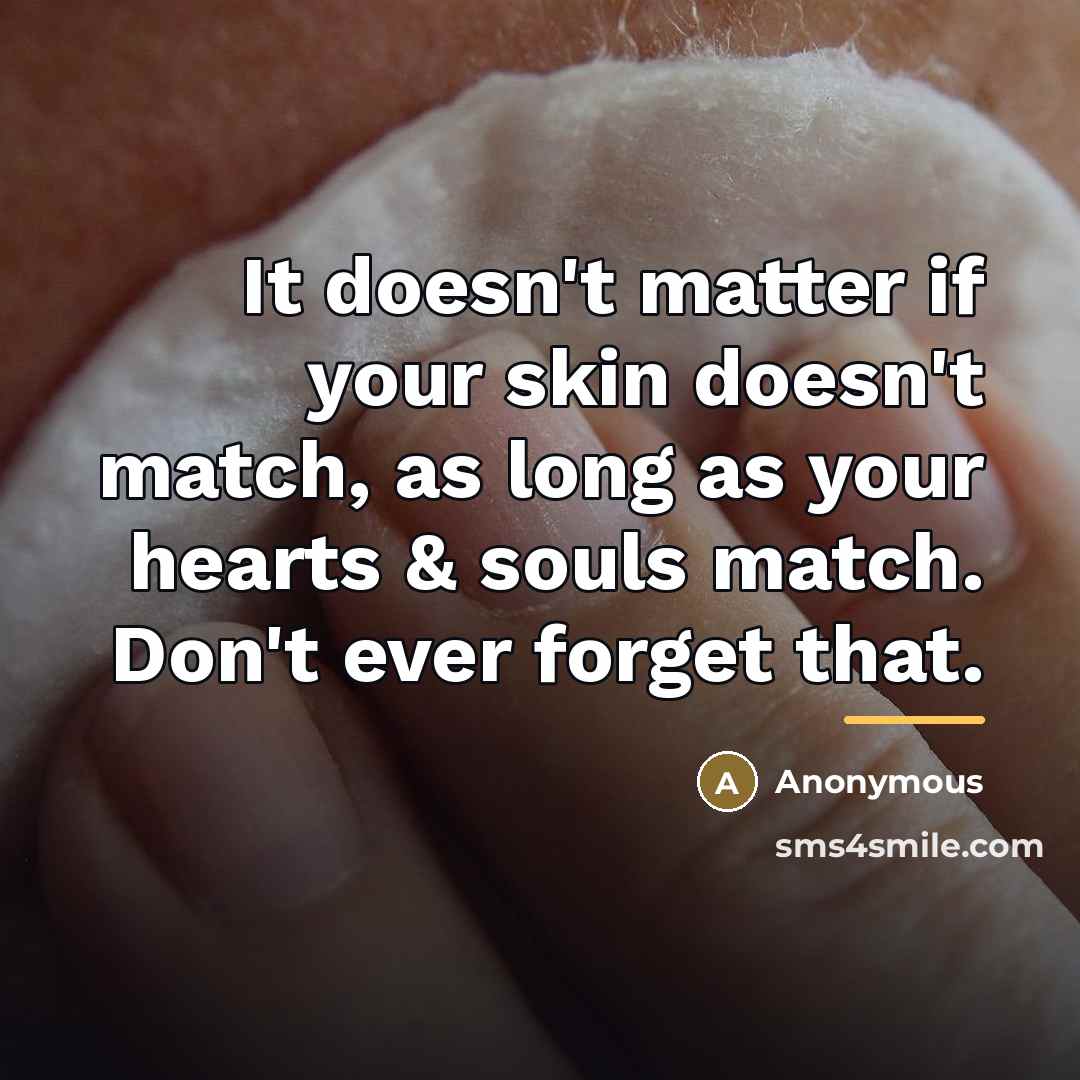“It doesn't matter if your skin doesn't match, as long…” quote by Anonymous