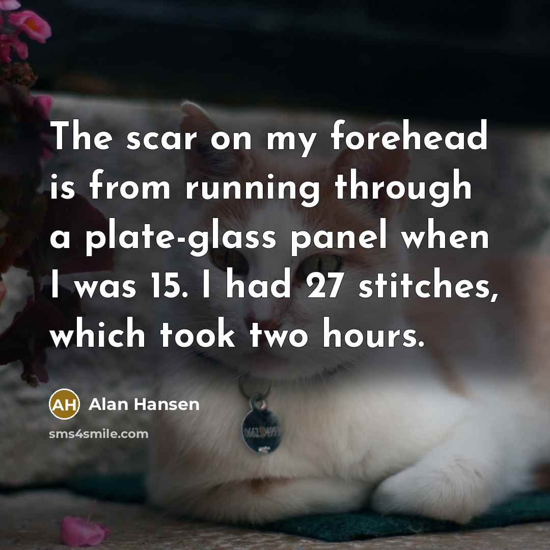 “The scar on my forehead is from running through a…” quote by Alan Hansen
